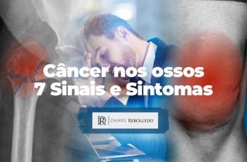Câncer nos ossos- 7 Sinais e Sintomas