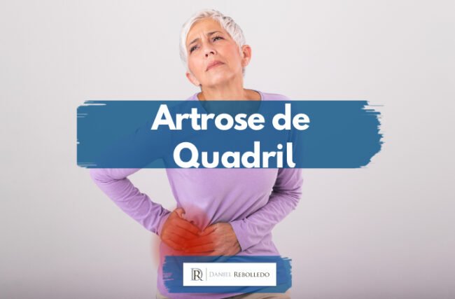 Artrose de Quadril (Osteoartrose)